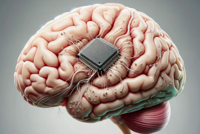 أول شريحة مزروعة في دماغ إنسان تواجه مشكلة.. ماذا حدث؟